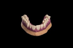 Imprimantes 3D pour prothèses dentaires et auditives