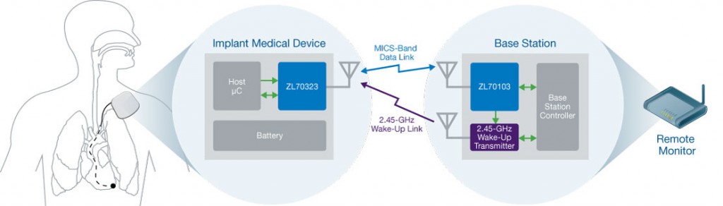 0177_block-diagram-for-ZL70323